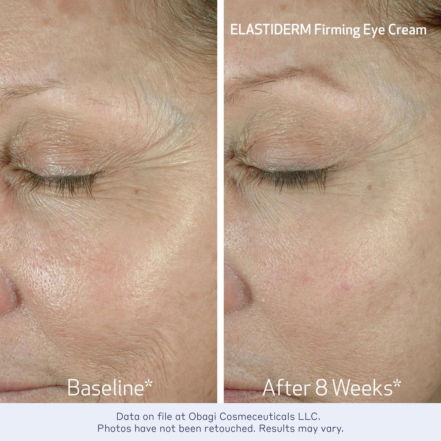Obagi ELASTIDERM Lift Up & Sculpt Facial Moisturizer and Eye Cream Set – Clinically Proven Anti-Aging Face Cream 1.7oz & Lightweight Eye Cream .5oz Help Reduce the Appearance of Fine Lines & Wrinkles